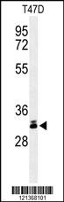 Anti-DKK1 Rabbit Polyclonal Antibody