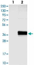 Anti-ABHD13 Rabbit Polyclonal Antibody