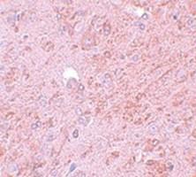 Anti-PIAS4 Rabbit Polyclonal Antibody