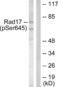 Western blot analysis of lysates from HeLa cells treated with UV 15' using Anti-RAD17 (phospho Ser645) Antibody. The right hand lane represents a negative control, where the Antibody is blocked by the immunising peptide