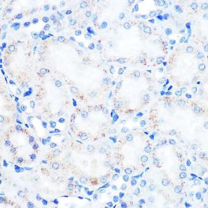 Immunohistochemistry analysis of paraffin-embedded rat kidney using Anti-LAMP2 Antibody [ARC0274] (A305918) at a dilution of 1:100 (40X lens). Perform microwave antigen retrieval with 10 mM PBS buffer pH 7.2 before commencing with IHC staining protocol