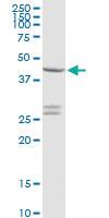 Anti-CXADR Rabbit Polyclonal Antibody