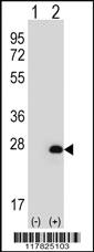 Anti-HPRT1 Rabbit Polyclonal Antibody