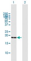 Anti-SOD1 Mouse Polyclonal Antibody