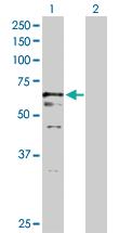 Anti-USP2 Rabbit Polyclonal Antibody