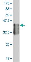 Anti-Thr Mouse Monoclonal Antibody [clone: 5E11]