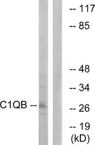 Western blot analysis of lysates from Jurkat cells using Anti-C1QB Antibody. The right hand lane represents a negative control, where the antibody is blocked by the immunising peptide