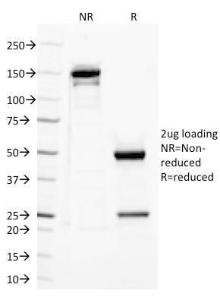 Anti-TLR2 Mouse Monoclonal Antibody [clone: TLR2/221]