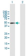 Anti-CXADR Rabbit Polyclonal Antibody