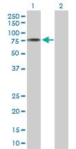 Anti-ACSM3 Rabbit Polyclonal Antibody