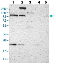 Anti-TMF1 Rabbit Polyclonal Antibody