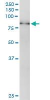 Anti-RPS6KB1 Polyclonal Antibody Pair