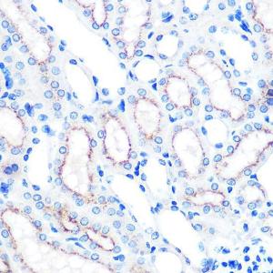 Immunohistochemistry analysis of paraffin-embedded mouse kidney using Anti-LAMP2 Antibody [ARC0274] (A305918) at a dilution of 1:100 (40X lens). Perform microwave antigen retrieval with 10 mM PBS buffer pH 7.2 before commencing with IHC staining protocol