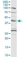 Anti-CXADR Rabbit Polyclonal Antibody