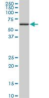 Anti-ACSM3 Rabbit Polyclonal Antibody