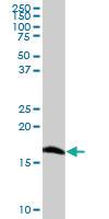 Anti-SOD1 Mouse Polyclonal Antibody