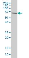 Anti-IRAK3 Mouse Monoclonal Antibody [clone: 1F6]