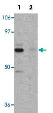 Anti-PIAS4 Rabbit Polyclonal Antibody