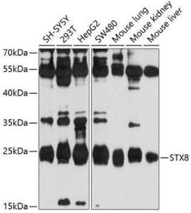 Western blot analysis of extracts of various cell lines, using Anti-Syntaxin 8 Antibody (A11228) at 1:1,000 dilution