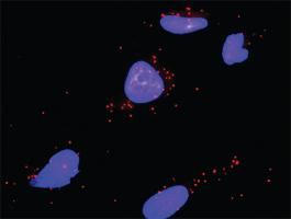 Anti-IKBKB + CLTC Antibody Pair