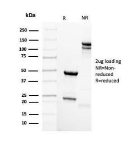 SDS-PAGE analysis of Anti-Mammaglobin A Antibody [rMGB/4299] under non-reduced and reduced conditions; showing intact IgG and intact heavy and light chains, respectively. SDS-PAGE analysis confirms the integrity and purity of the Antibody