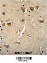 Anti-CPLX3 Rabbit Polyclonal Antibody (HRP (Horseradish Peroxidase))