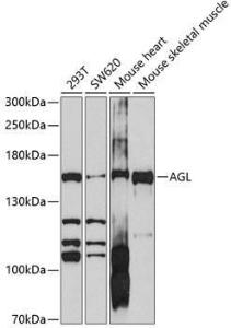 Western blot analysis of extracts of various cell lines, using Anti-AGL / Alpha-glucosidase Antibody (A11229) at 1:1,000 dilution. The secondary antibody was Goat Anti-Rabbit IgG H&L Antibody (HRP) at 1:10,000 dilution.