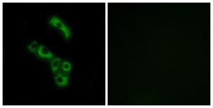 Immunofluorescence analysis of A549 cells using Anti-C1QB Antibody. The right hand panel represents a negative control, where the antibody was pre-incubated with the immunising peptide