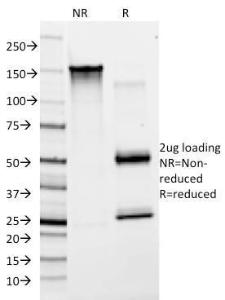 SDS-PAGE analysis of Anti-Von Willebrand Factor Antibody [F8/86] under non-reduced and reduced conditions; showing intact IgG and intact heavy and light chains, respectively. SDS-PAGE analysis confirms the integrity and purity of the antibody.