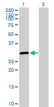 Anti-SALL2 Rabbit Polyclonal Antibody