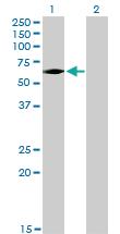 Anti-IRAK3 Mouse Monoclonal Antibody [clone: 1F6]