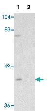 Anti-SAE1 Rabbit Polyclonal Antibody