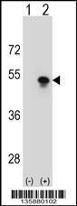 Anti-SNAPC1 Rabbit Polyclonal Antibody (AP (Alkaline Phosphatase))