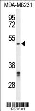 Anti-CBX2 Rabbit Polyclonal Antibody [clone: 429CT16.3.1]