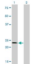 Anti-SALL2 Mouse Monoclonal Antibody [clone: 3F7]