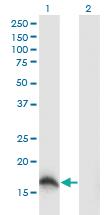 Anti-SOD1 Mouse Monoclonal Antibody [clone: 10D5]