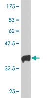 Anti-HAND2 Mouse Monoclonal Antibody [clone: 3D5]