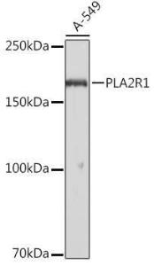 Anti-PLA2R Antibody (A11232)