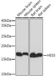 Western blot analysis of extracts of various cell lines, using Anti-HES5 Antibody [ARC1740] (A308760) at 1:1,000 dilution. The secondary antibody was Goat Anti-Rabbit IgG H&L Antibody (HRP) at 1:10,000 dilution.