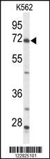 Anti-ACSS2 Rabbit Polyclonal Antibody