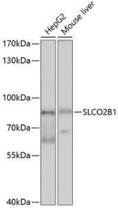 Anti-SLCO2B1/OATP2B1 antibody