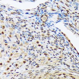 Immunohistochemistry analysis of paraffin-embedded rat ovary using Anti-HES5 Antibody [ARC1740] (A308760) at a dilution of 1:100 (40x lens). Perform microwave antigen retrieval with 10 mM Tris/EDTA buffer pH 9.0 before commencing with IHC staining protocol.