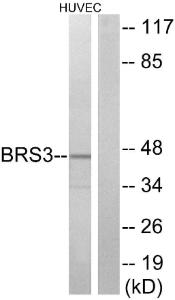 Antibody anti-BRS3 A100011-100 100 µg