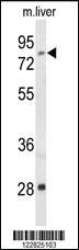 Anti-ACSS2 Rabbit Polyclonal Antibody