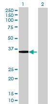 Anti-B4GALT4 Mouse Polyclonal Antibody