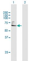 Anti-TGM2 Rabbit Polyclonal Antibody