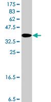 Anti-NSD1 Mouse Polyclonal Antibody