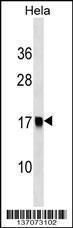 Anti-AP2S1 Rabbit Polyclonal Antibody (HRP (Horseradish Peroxidase))