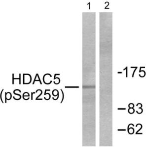 Western blot analysis of lysates from HepG2 cells using Anti-HDAC5 (phospho Ser259) Antibody. The right hand lane represents a negative control, where the Antibody is blocked by the immunising peptide