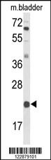 Anti-DGCR6 Rabbit Polyclonal Antibody